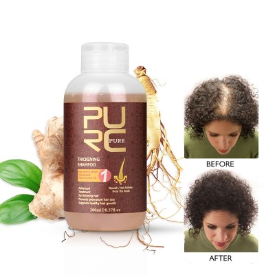 China Manufacture natural organic ginger hair anti loss growth treatments shampoo and conditioner for men women hair fall