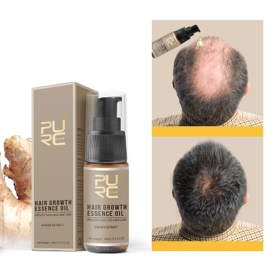 Custom Private Label Natural Ginger Germinal Hair Regrowth Treatment Essenti Oil Hair Anti Loss Growth Serum Oil For Men Women