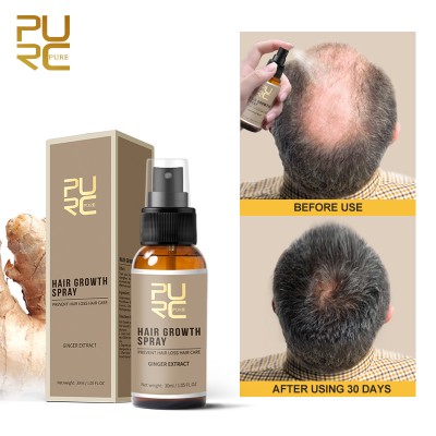 Hair Growth & Anti Hair Loss Spray Keep Hair Regrowth fastly and rich in ginger extract