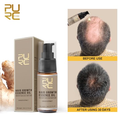 Ginseng Ginger Hair Growth & Anti Hair Loss Serum Keep Hair Regrowth