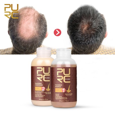 Treatment repair genetic hair loss products natural organic ginger growth hair thickening shampoo and conditioner set for sale